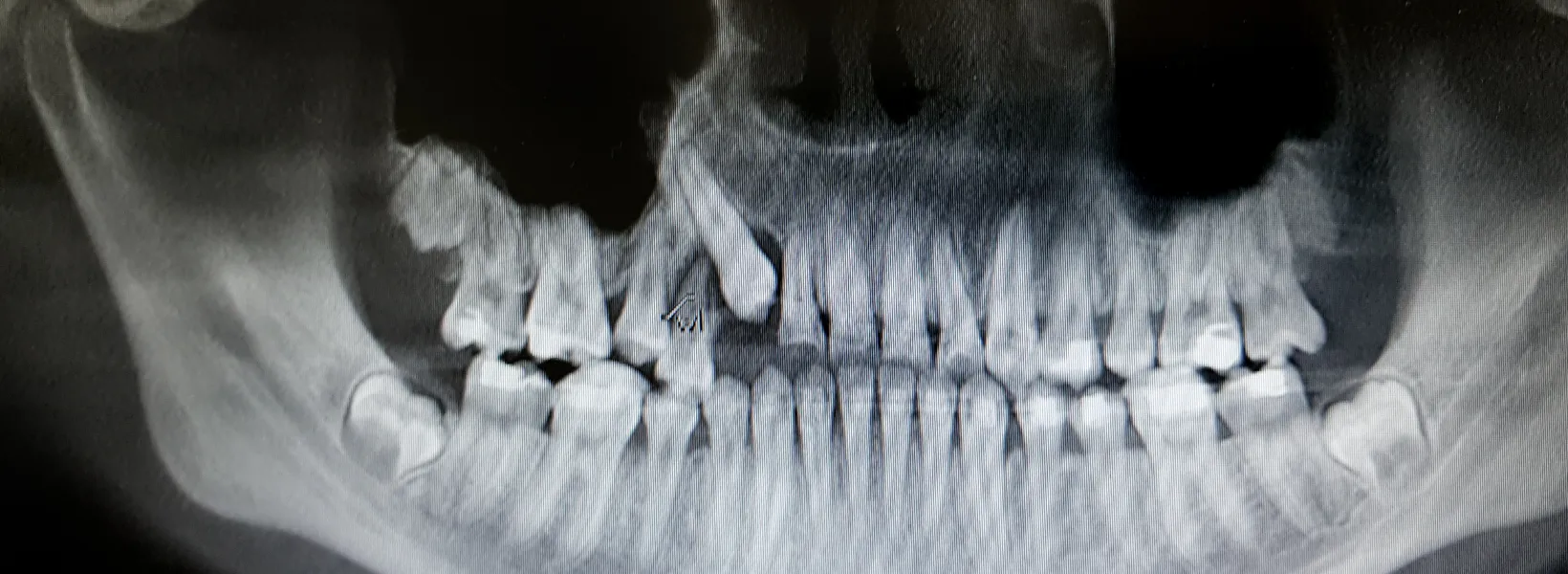 smiling man outside